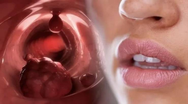 3 أعراض فموية تدل على حالة صحية خطيرة