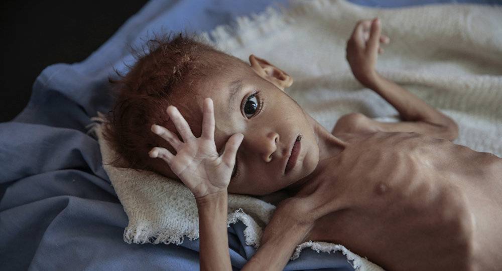 بالفيديو۔۔۔ الكوليرا تستفحل في اليمن... مليون و700 ألف إصابة حتى الآن