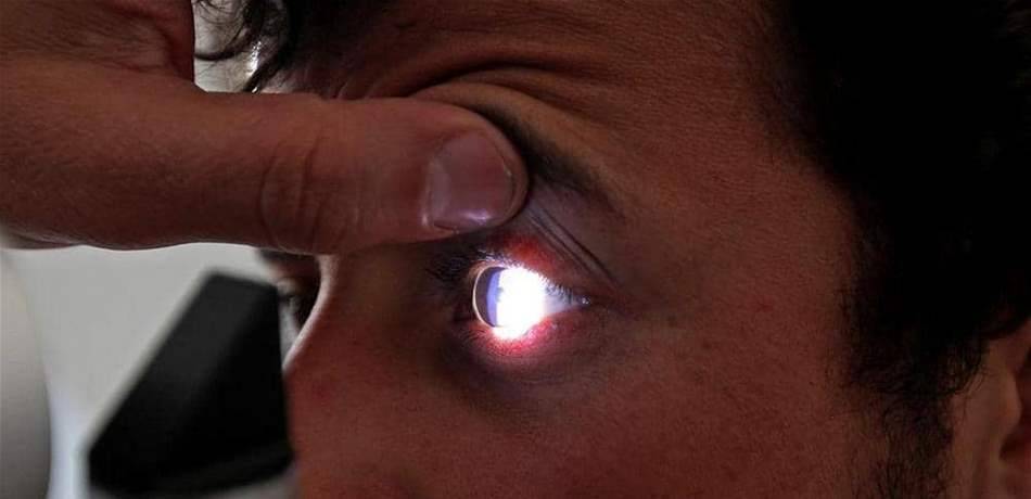 اصفرار العين.. مؤشر بسيط على أمراض خطيرة!