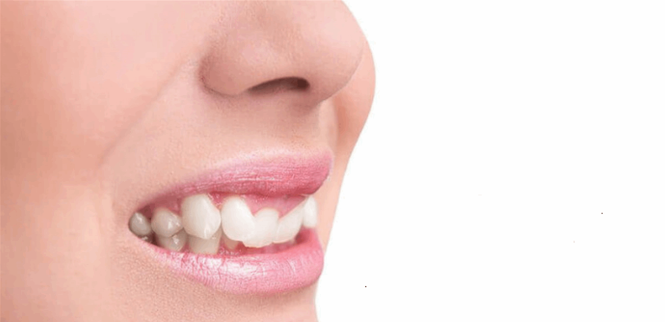 إحذروا الابتسام بهذه الطريقة قد يسبب أمراضاً خطرة!