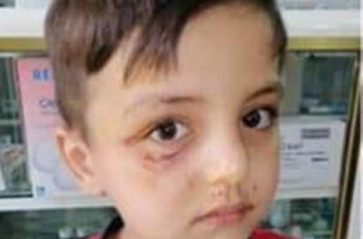 واوي هاجم طفلين في بلدة ديركيفا الجنوبية