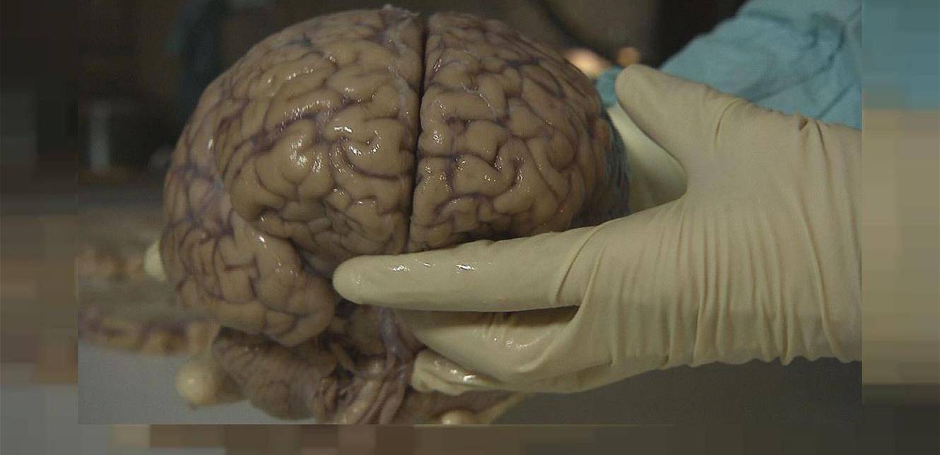 بحجم الحوت الأزرق.. جهاز أشعة جديد يكشف أمراض الدماغ