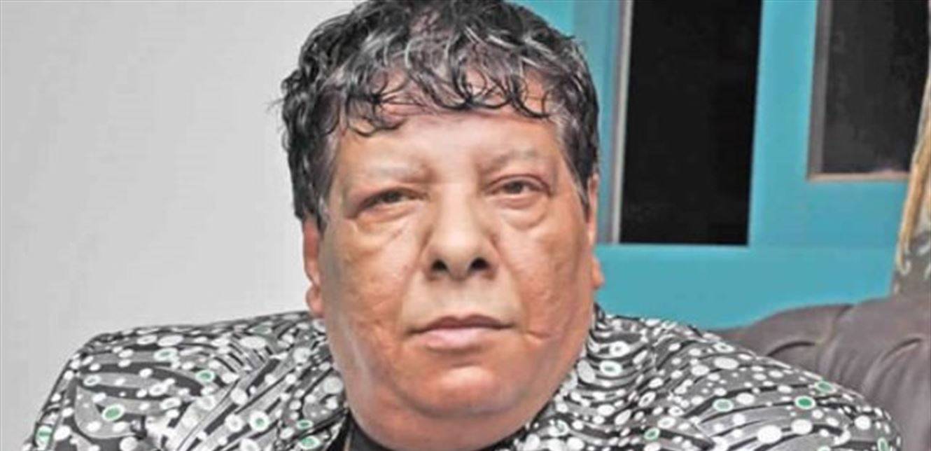بعد تعرضه لكسر.. هذه حالة شعبان عبدالرحيم الصحية