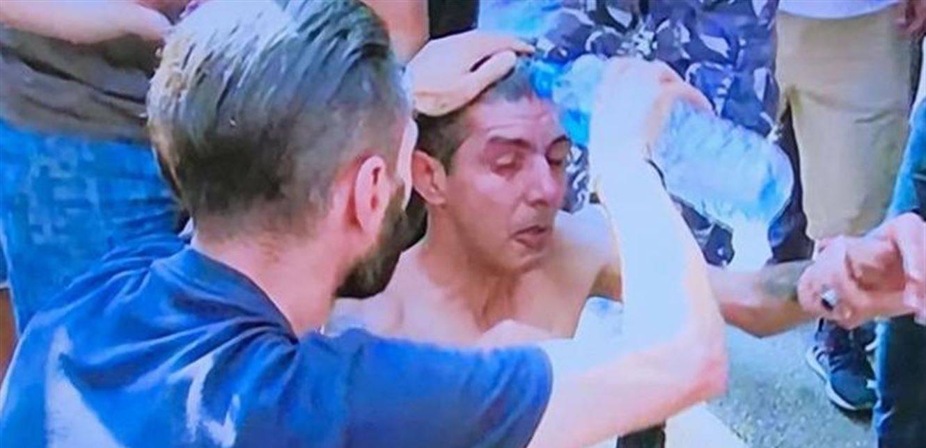 حاول إحراق نفسه.. إليكم التفاصيل