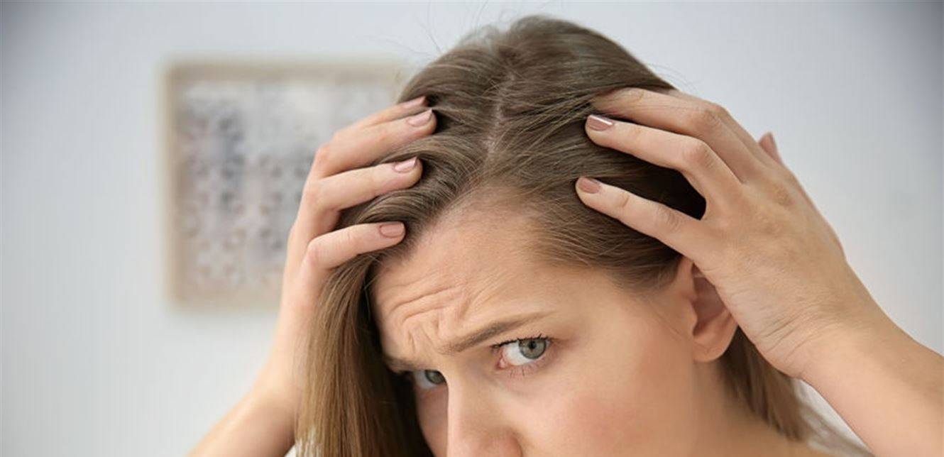 لماذا يتساقط شعرك في الشتاء؟