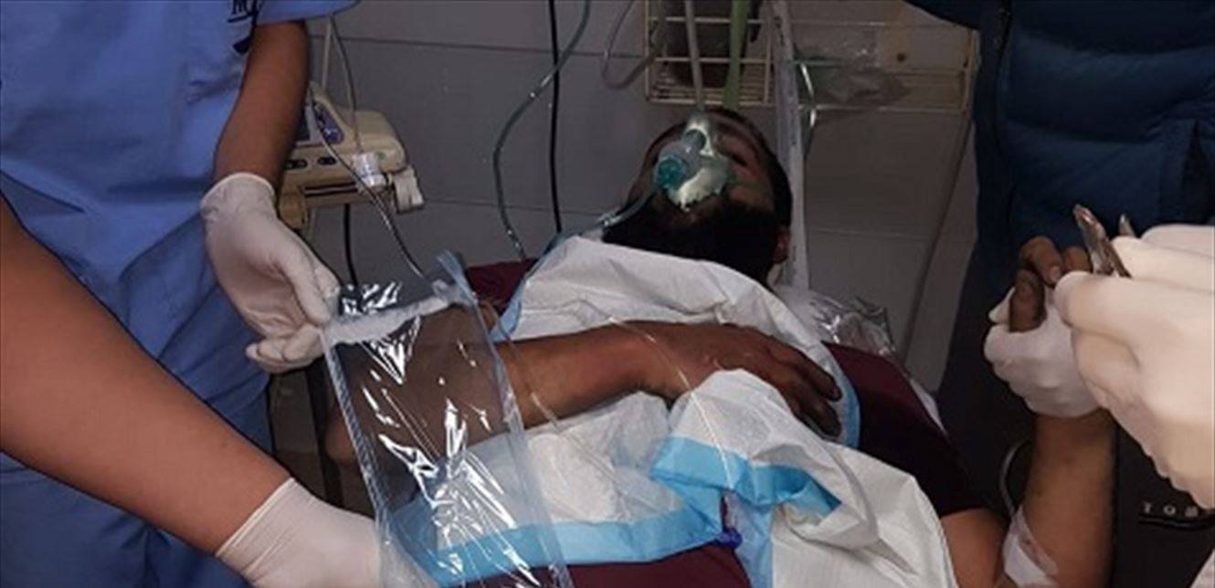 أصيب بحروق اثناء قيامه باشعال الاطارات على اتوستراد الجية (صورة)