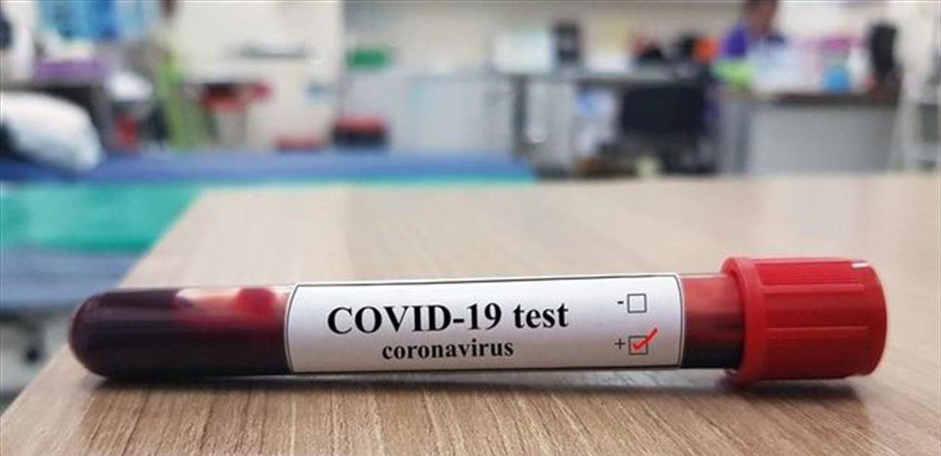 اليكم تقرير غرفة ادارة الكوارث في محافظة عكار عن مستجدات الفيروس