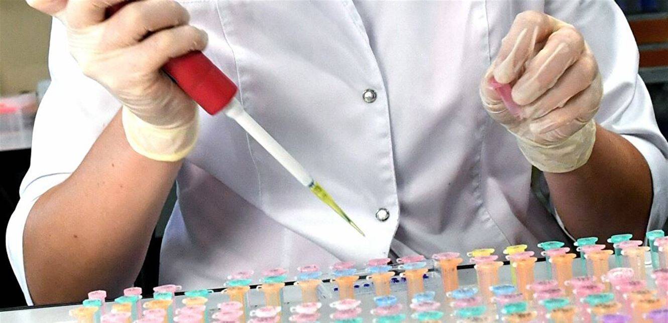 عدوى فطرية تنتشر في صالونات الحلاقة والتجميل.. "قد تسبب أمراضا حرجة"!