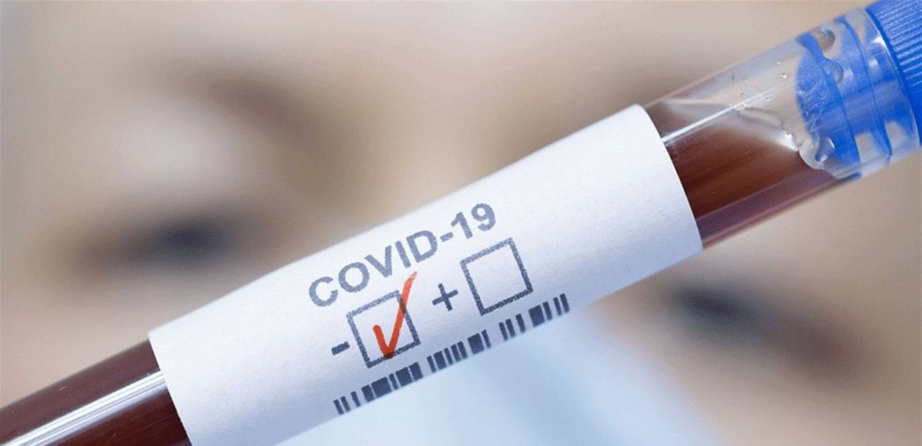 بلدية بزيزا: نتائج الـ PCR للمخالطين سلبية