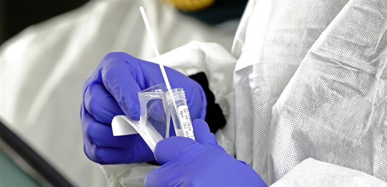 إحذروا من الـpcr.. إنقاذ مريضة سقطت المسحة في رئتها عبر أنبوب التنفس (صورة)