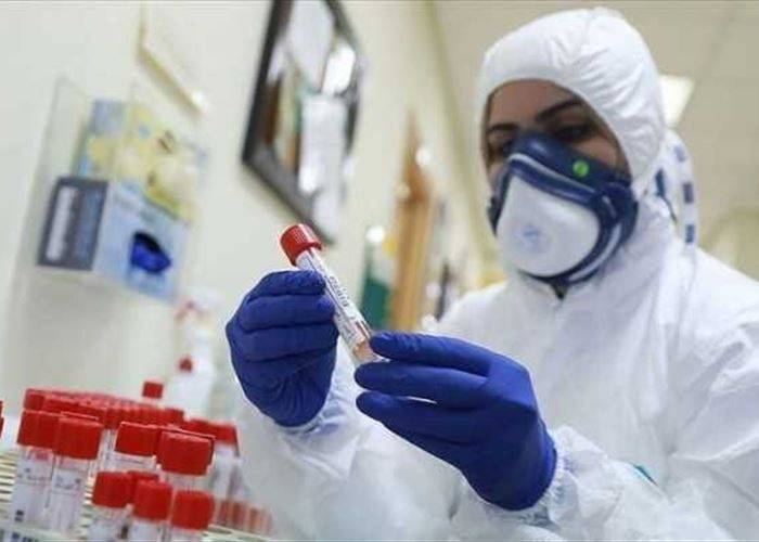 «كورونا»: 24 حالة وفاة و1859 اصابة جديدة