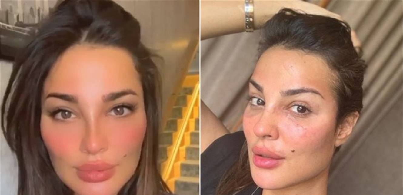دموع وذكريات.. نادين نسيب نجيم تتحدّث عن تجربتها الأليمة بانفجار بيروت