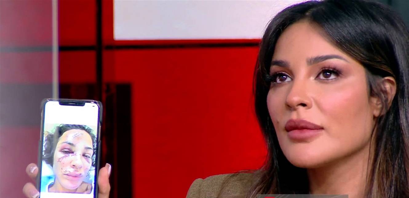 للمرة الأولى صور من غرفة العمليات تظهر جروحها.. نادين نسيب نجيم تروي لحظات انفجار بيروت وتبكي