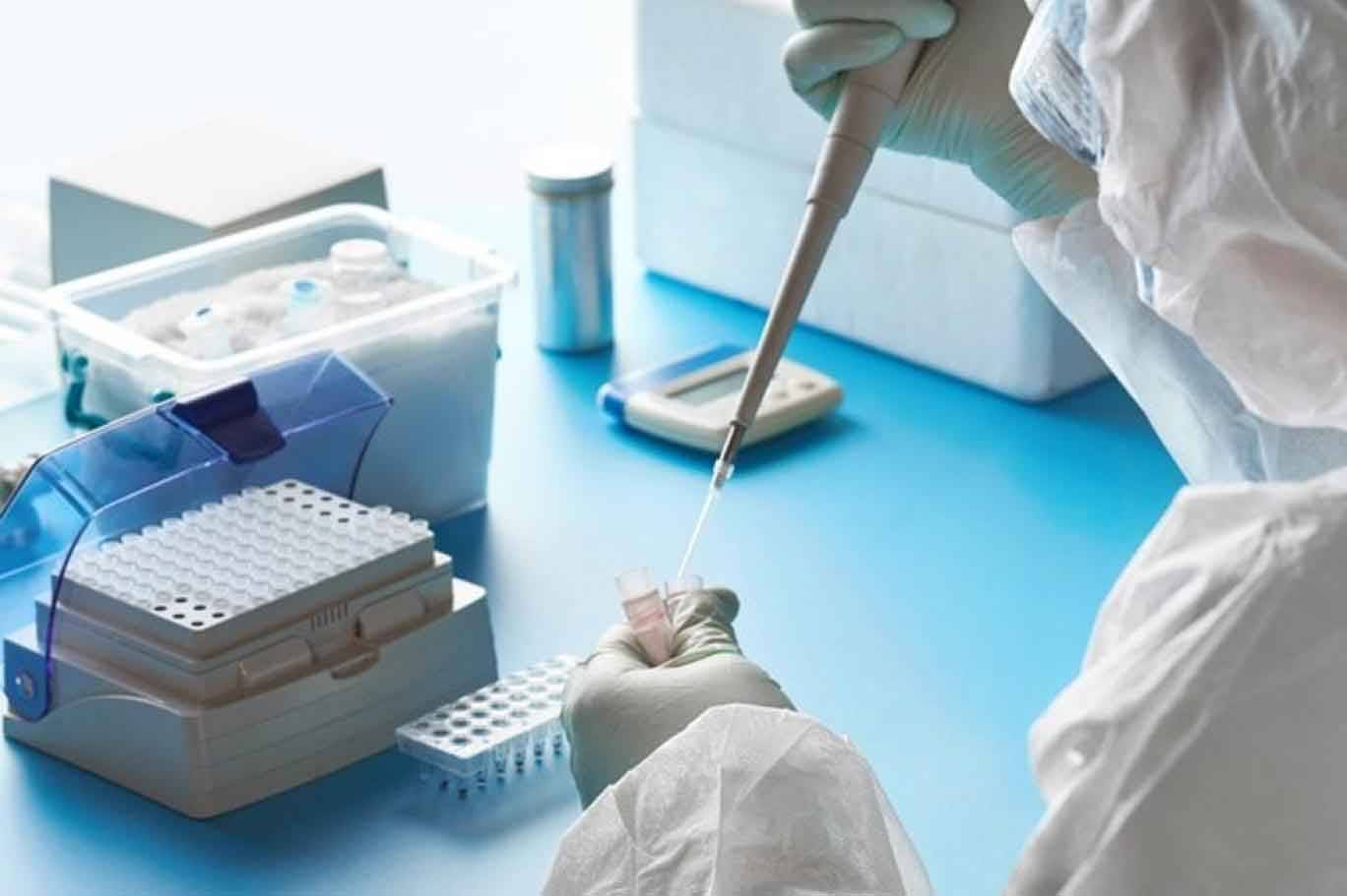 «كورونا» : 10 حالات وفاة و1093 اصابة جديدة