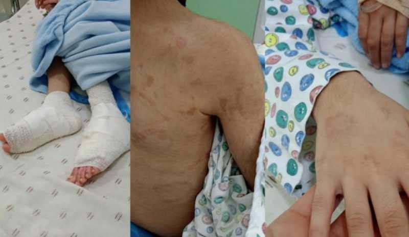 ابنة الـ7 سنوات تتعرّض لاعتداء على يد زوجة والدها..