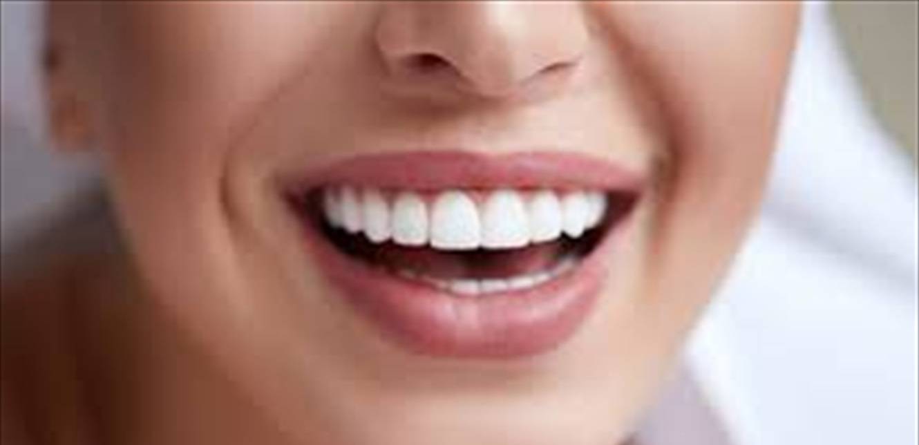 لتبييض أسنانك في المنزل... طبّقي هذه الوصفات السهلة!