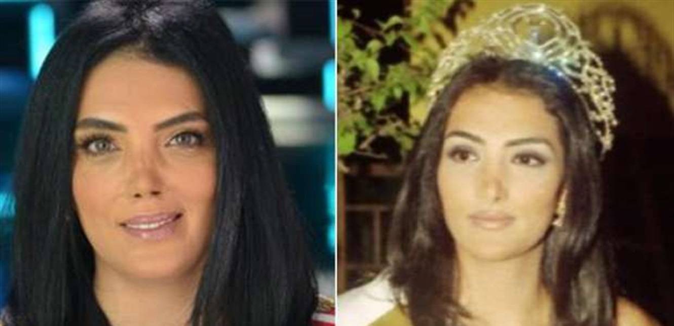 ذهبت الى اميركا لترمم أنفها فإنخفضت نسبة الهيموغلوبين لديها.. هذا ما حصل مع الفنانة الشهيرة (صور)