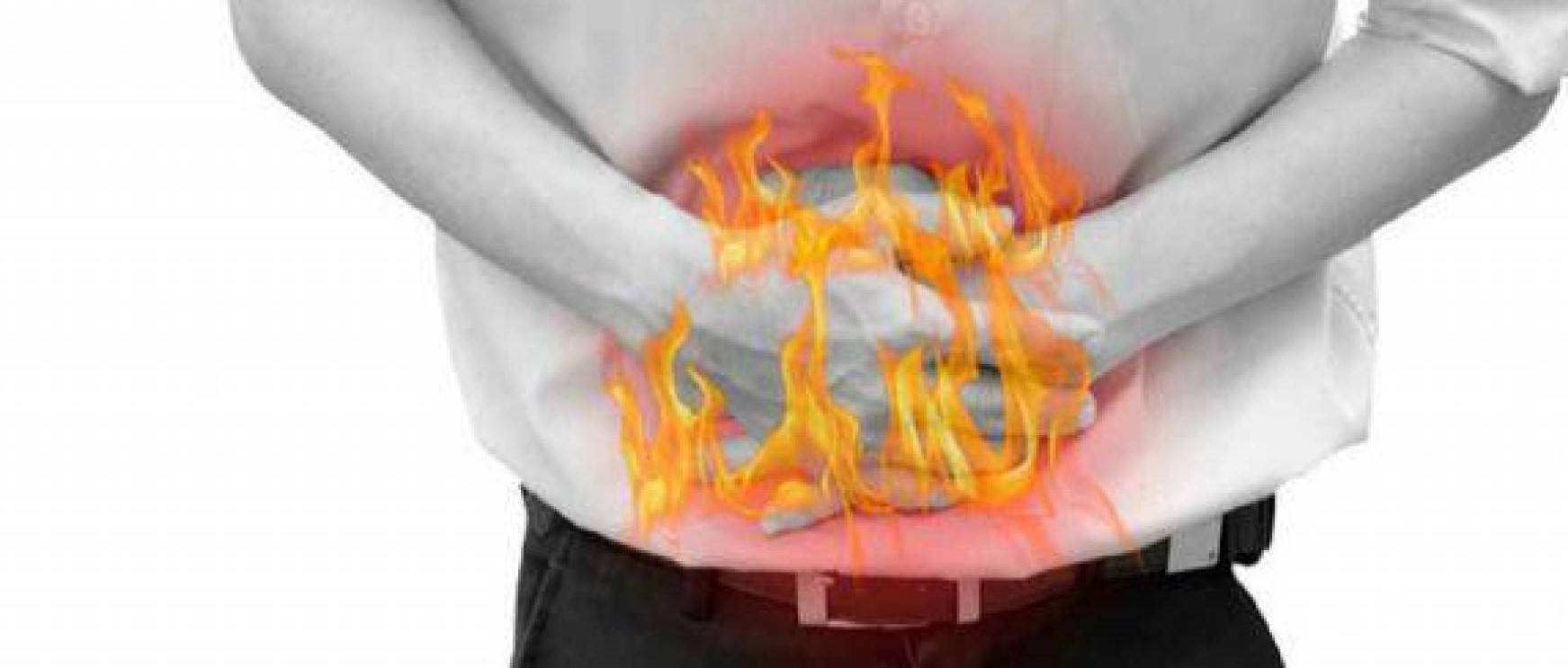 طبيب يحذر من خطورة الحرقة في المعدة