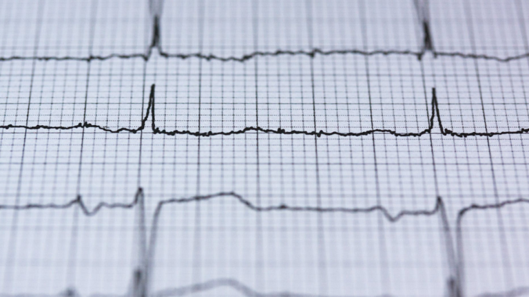 يمكن أن يقتل خلايا عضلة القلب .. دراسة تكشف كيفية استهداف "كوفيد-19" القلب