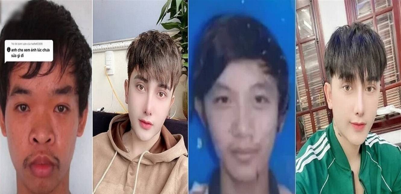 سخروا من شكله خلال مقابلة عمل فأجرى 9 عمليات تجميل ودفع أكثر من 17 ألف دولار!