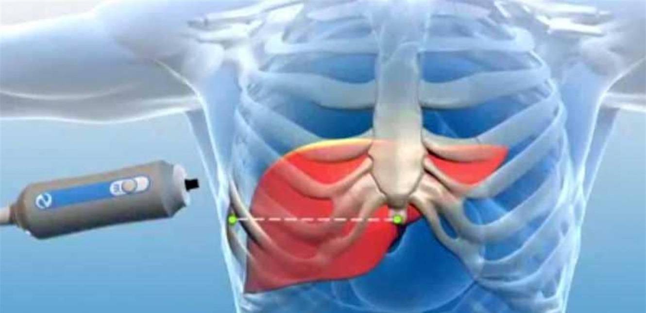 إذا شعرت بهذا الأمر ليلاً.. فأنت بحاجة إلى فحص الكبد