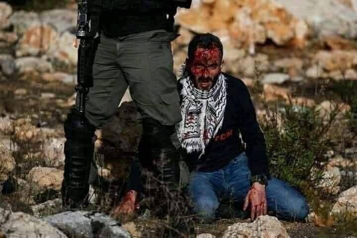 استشهاد شاب فلسطيني متأثراً بجروحه