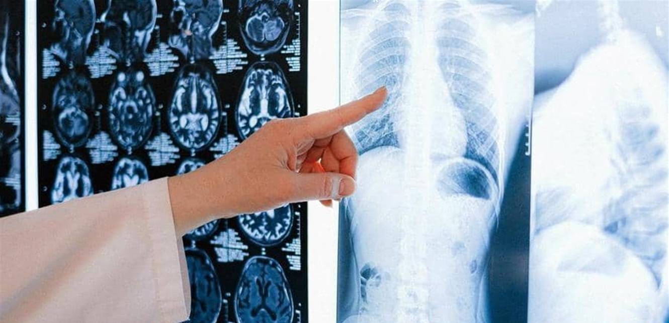 كيف يدمر فيروس كورونا رئة الإنسان؟.. دراسة حديثة تجيب