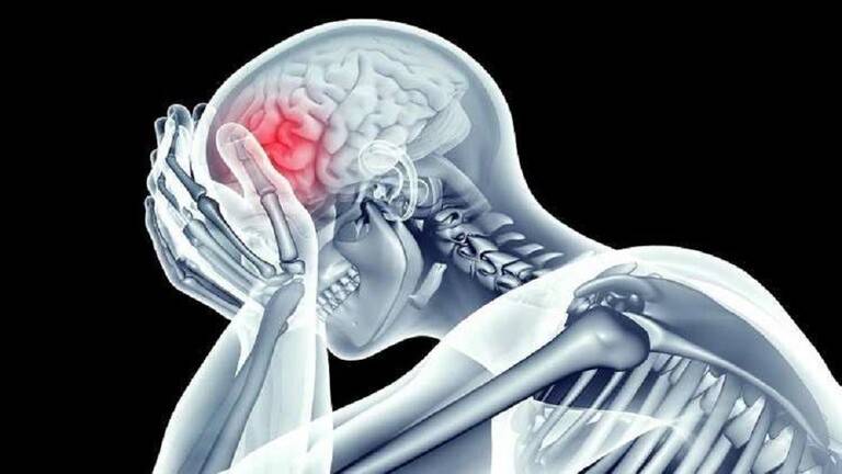 طبيب يكشف خطأ فادحا في علاج الجلطة الدماغية.. الدواء هو القاتل؟
