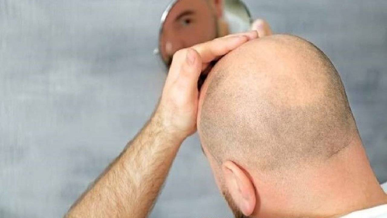 ما هي عجائب الصلعة السبع؟