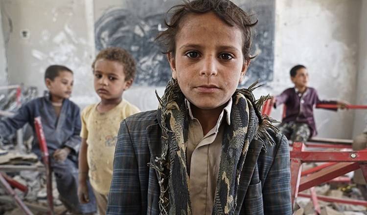 اليونيسيف: استشهاد أو تشوّه 10 آلاف طفل يمني