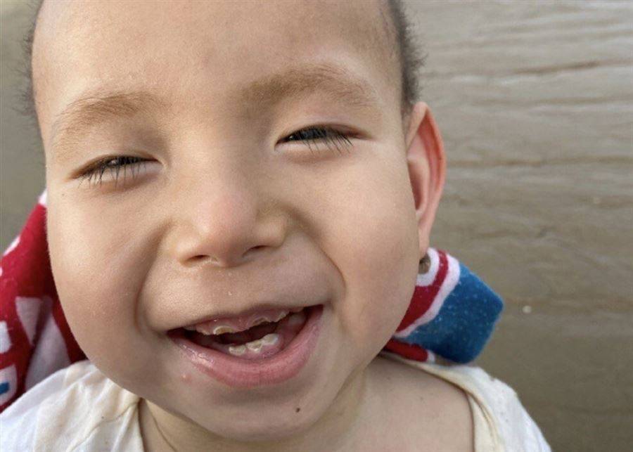 "الحاجة أم الإختراع".. هكذا الأب شووي أنقذ إبنه من الموت