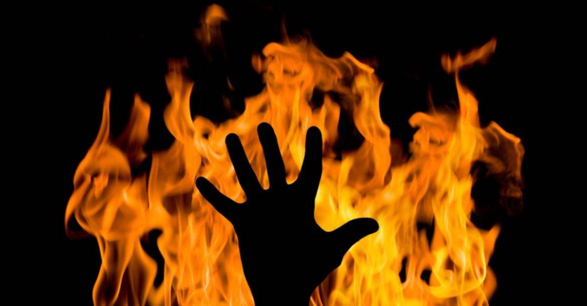 بالصور- أحرق زوجته السابقة أثناء بث مباشر على الإنترنت!