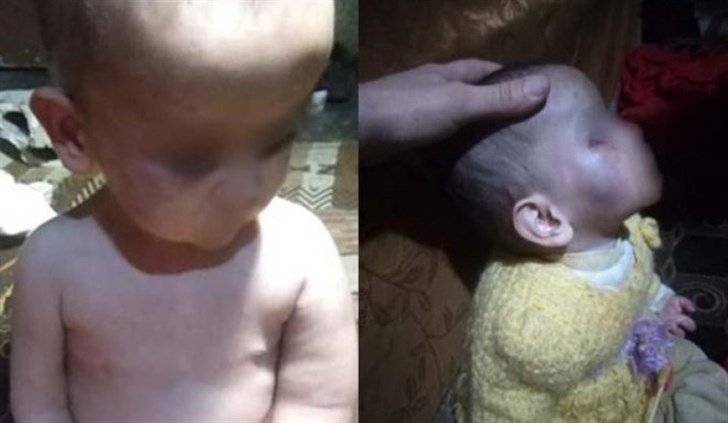 طفلتان تعرّضتا للتعنيف من قبل زوجة والدهما