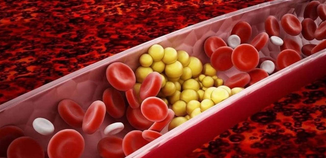 3 وصفات طبيعية لتخفيض الكوليسترول تعرفوا عليها