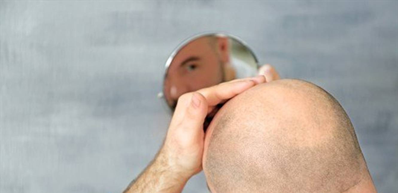هل يمكن توليد الكهرباء فعلا من الرأس الأصلع؟