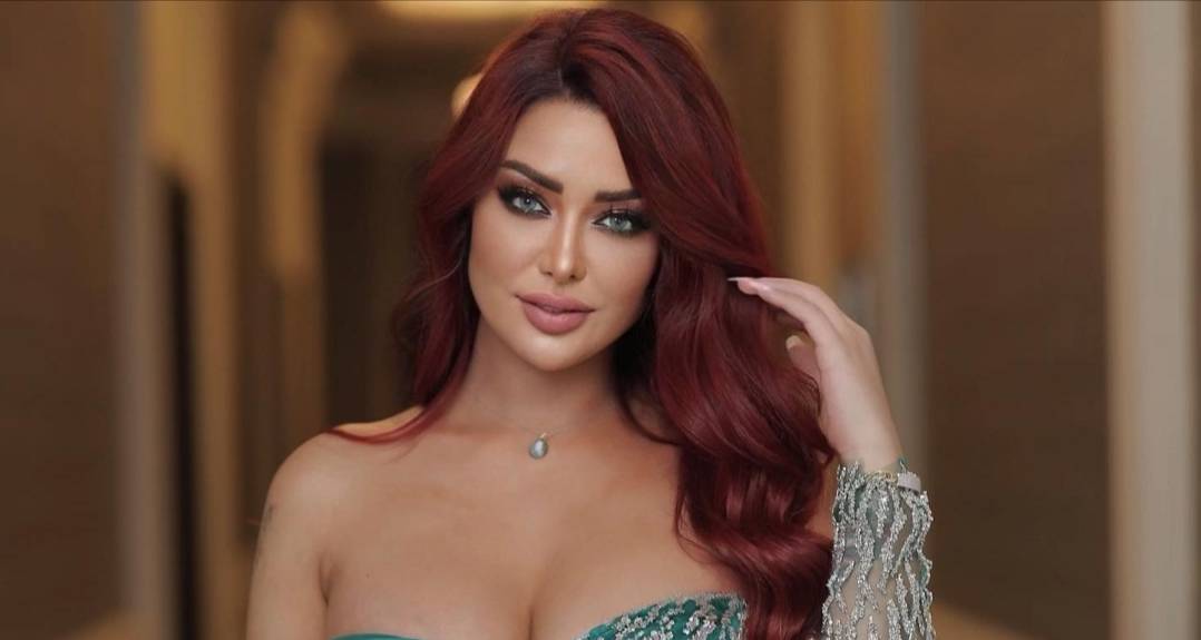 كاميليا ورد تعيش حالة وجع ولمن تقول راح...