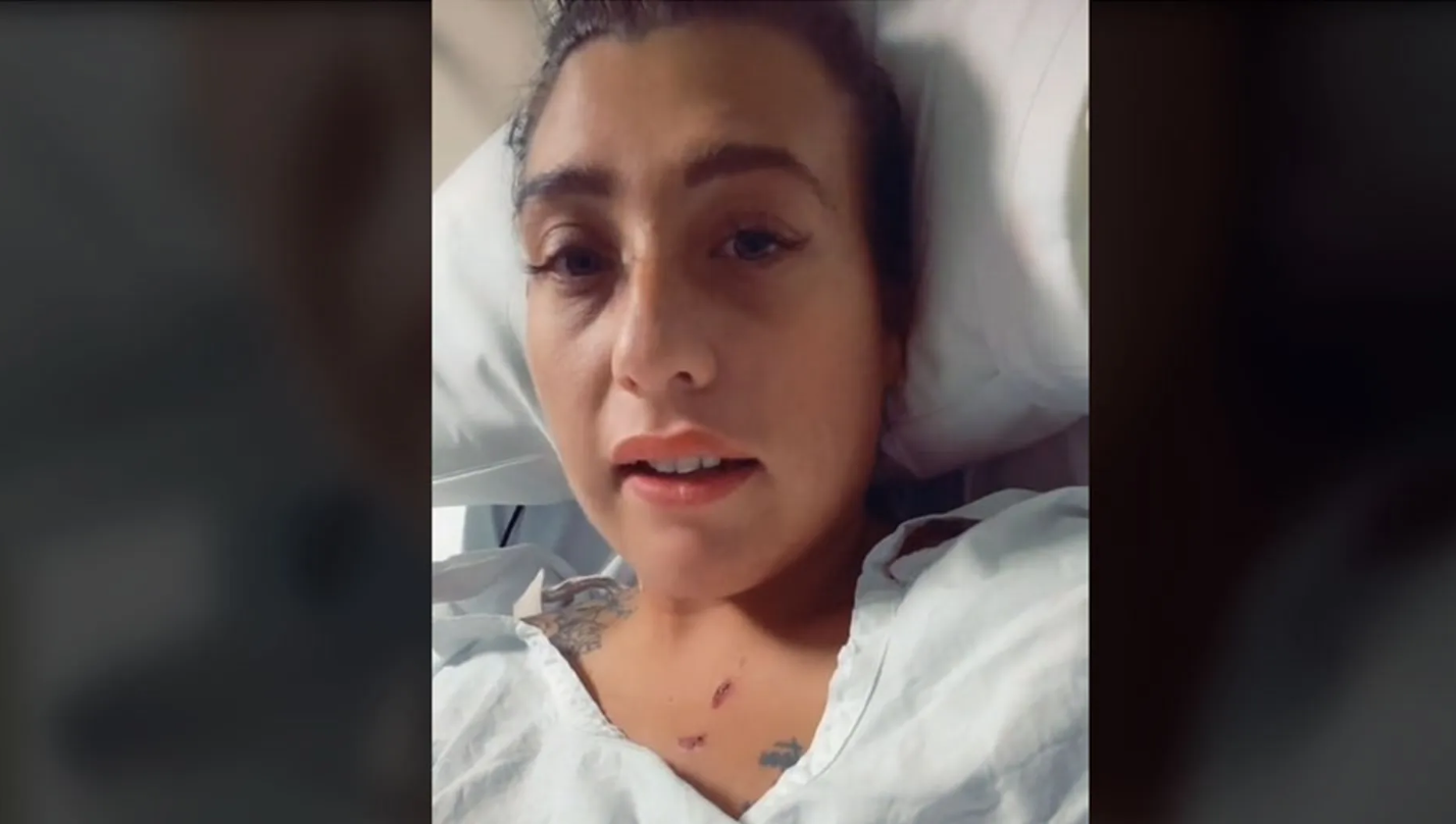 بعد عملية تجميل.. شابة تصاب بعدوى خطيرة نادرة