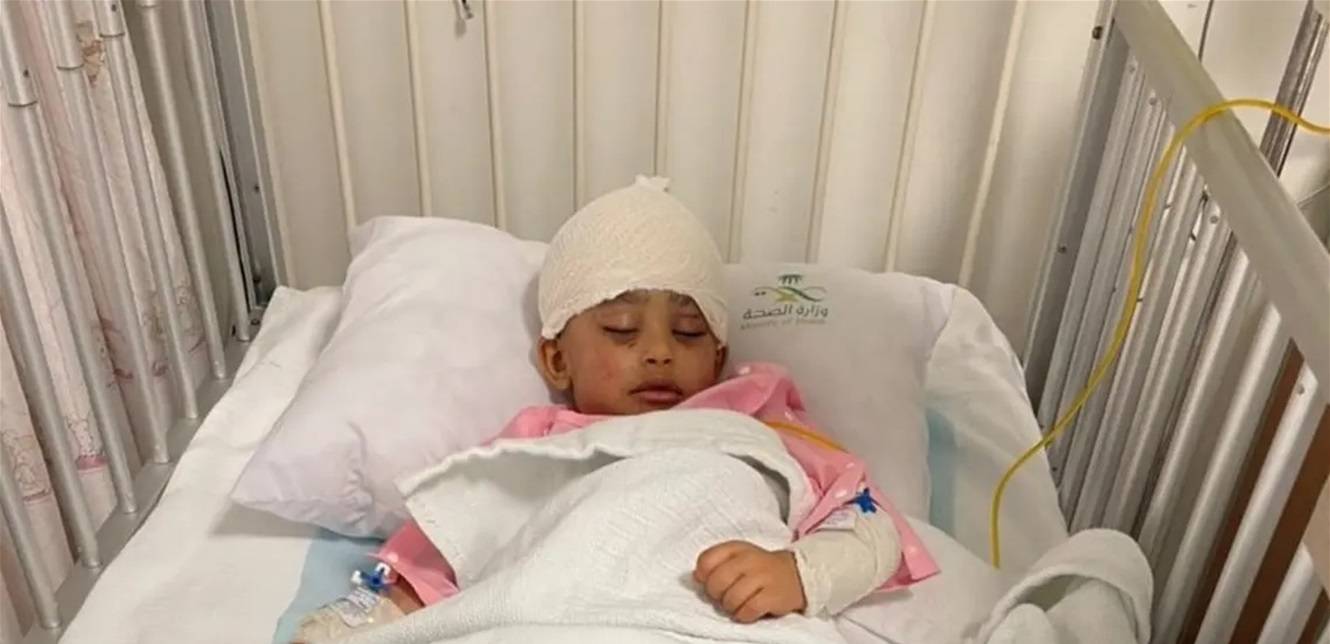 "حادثة أليمة"... 9 كلاب ضالة تنهش طفلاً !