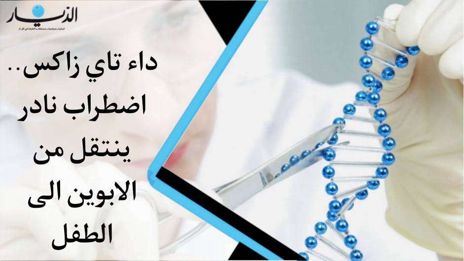 داء تاي زاكس.. اضطراب نادر ينتقل من الابوين الى الطفل!