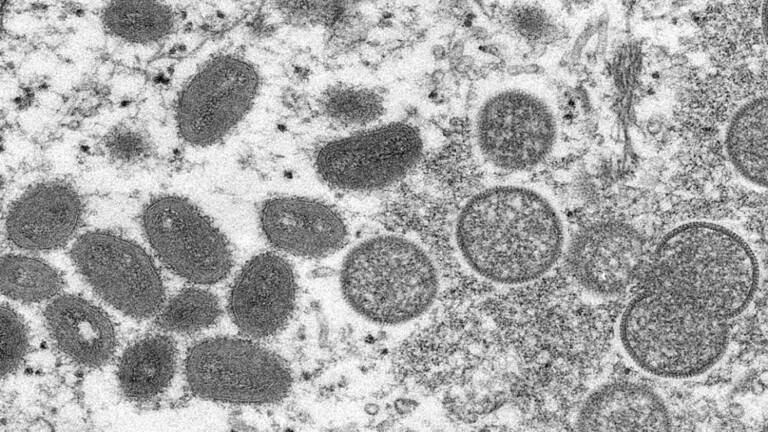 اكتشف عقار فعال في القضاء على فيروس جدري القردة