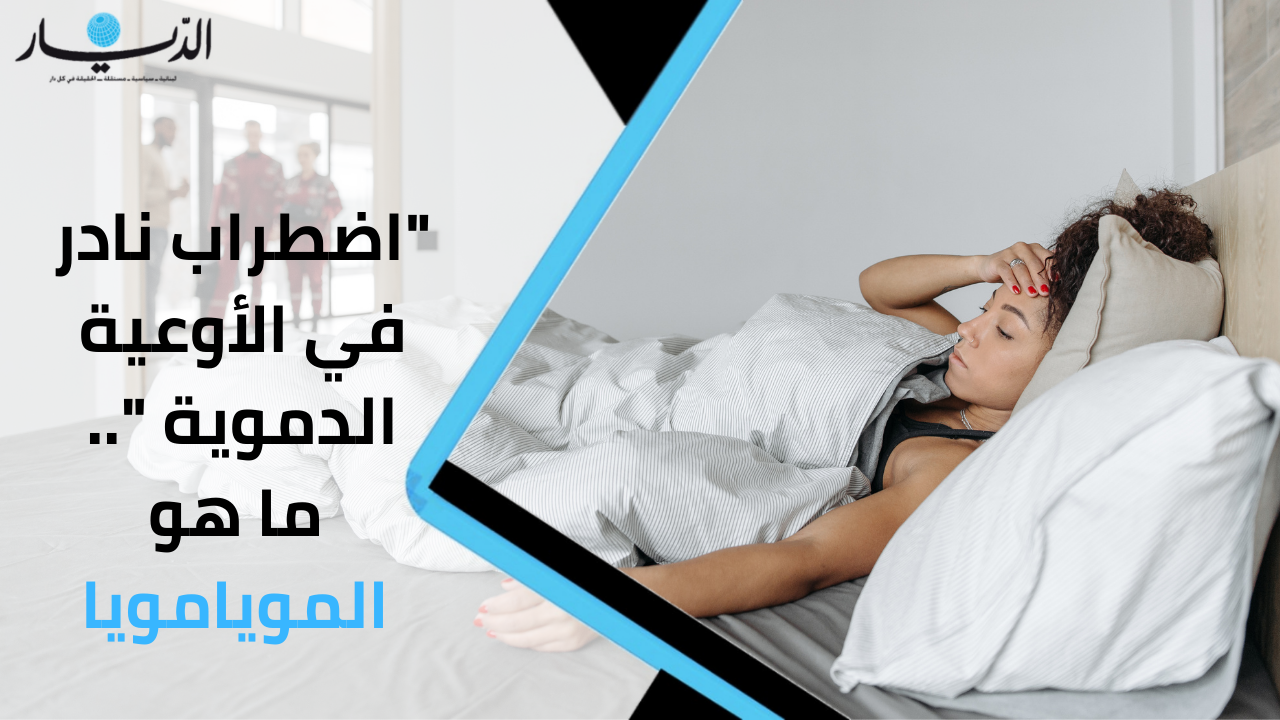 "اضطراب نادر في الأوعية الدموية".. ما هو المويامويا؟