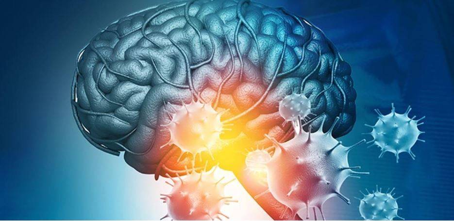 9 أشخاص توفوا سريعاً... ما سبب الأضرار الدماغية بعد الإصابة بـ"كورونا"؟