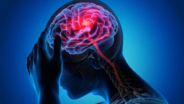 ابتكار مستحضر لاستعادة الدماغ بعد الجلطة الدماغية!