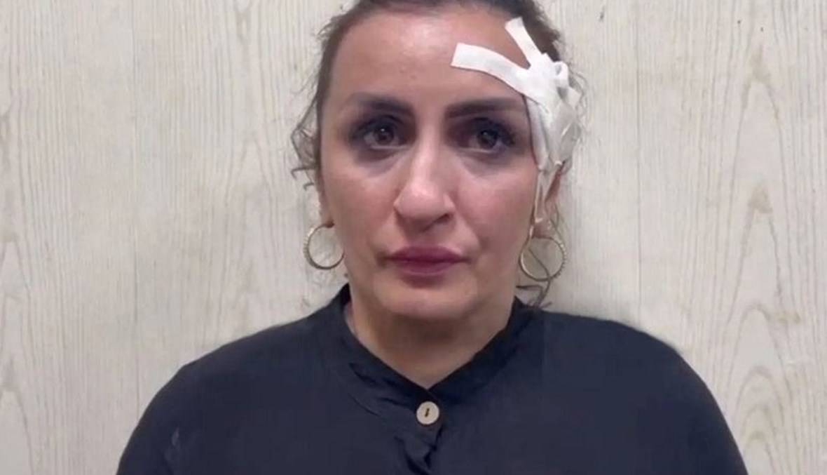 أم تبيع طفلها الرضيع بمبلغ باهظ  لإجراء عملية تجميل الأنف!