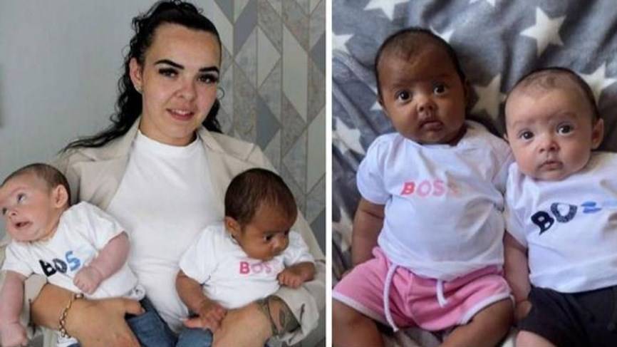 في بريطانيا.. توأم بلوني بشرة مختلفين