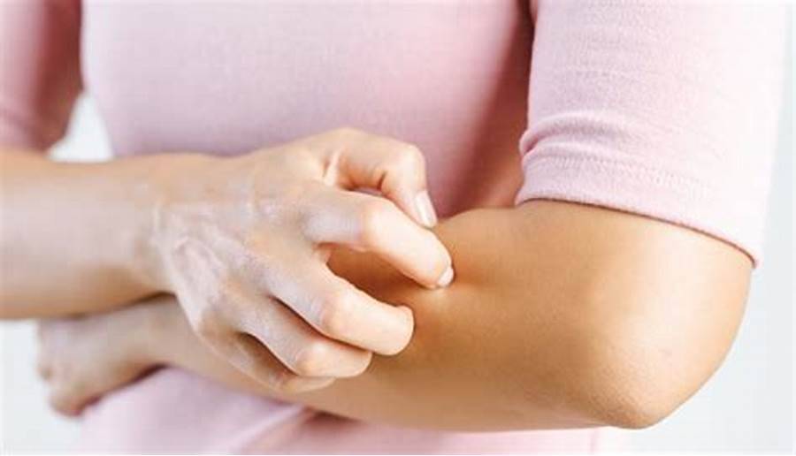 فصيلة دمك ولون ملابسك يعرضانك للدغات البعوض.. هذا ما توصلت اليه آخر الدراسات