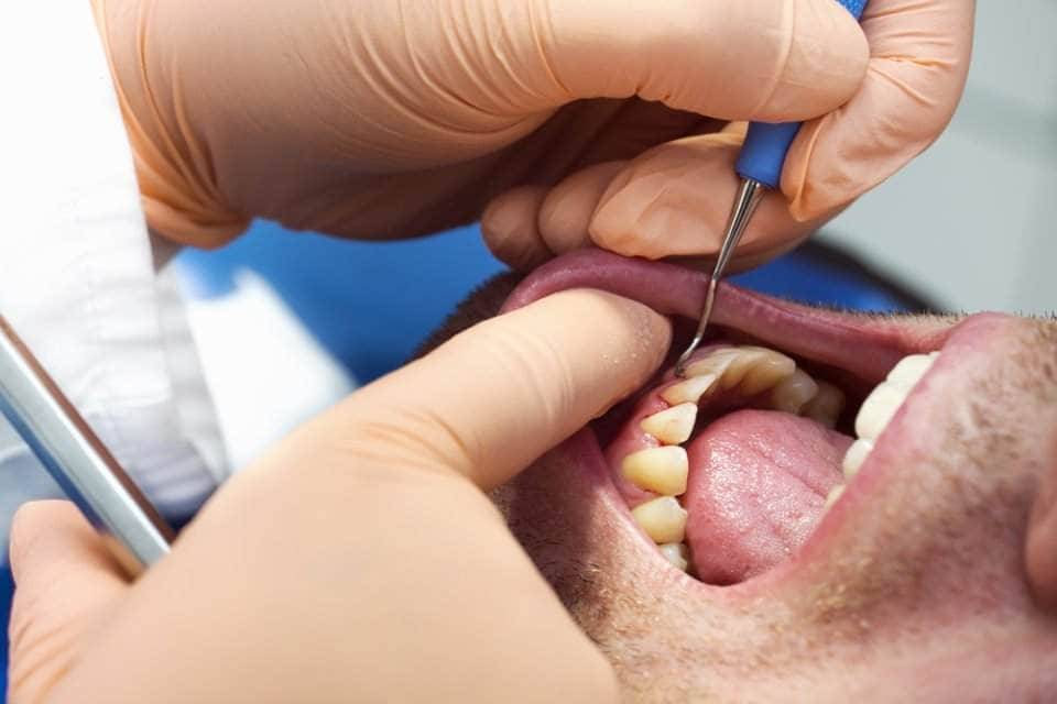 سوء صحّة الأسنان تتلف الرئة
... ماذا في التفاصيل؟