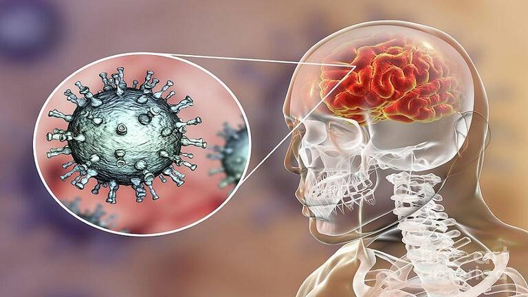 علماء: الإصابة بجدري القردة قد تسبب مضاعفات فسيولوجية عصبية