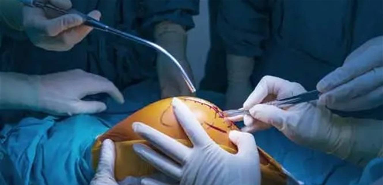 طبيب لبناني يُحقّق إنجازاً عالميّاً في مجال جراحة العظم... من هو؟