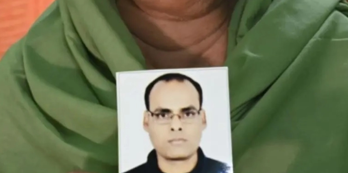 فقد حياته في عملية زراعة شعر!